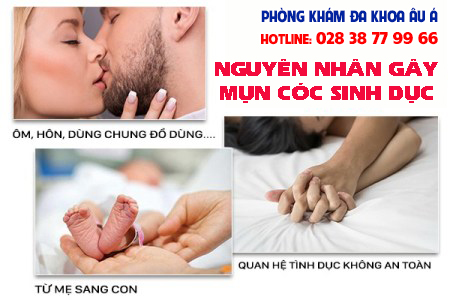
						Mụn Cóc Sinh Dục - Nguyên Nhân Và Cách Điều Trị Hiệu Quả