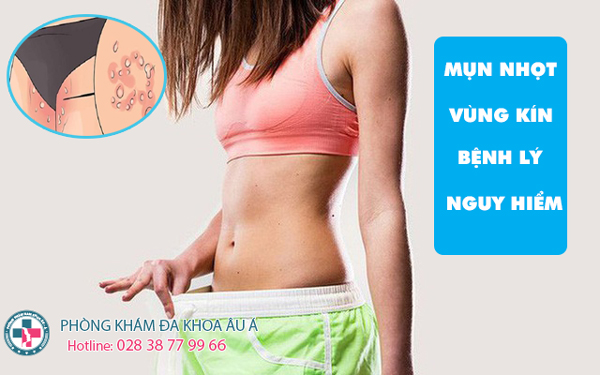 
						Mụn Nhọt Ở Vùng Kín Nữ Là Bệnh Gì? Có Nguy Hiểm Không?