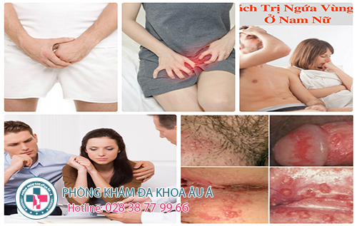 
						Ngứa Vùng Kín Và Cách Khắc Phục Hiệu Qủa, An Toàn