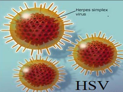 Tìm Hiểu Về Herpes – Căn bệnh hoa liễu Tiềm Tàng Nhiều Nguy Hiểm