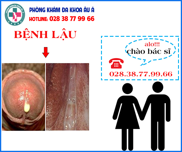 
						Làm Thế Nào Để Phán Đoán Bệnh Lậu