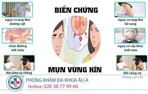 
						Mụn Vùng Kín - Cảnh Báo Bạn Mắc 1 Trong 3 Bệnh Nguy Hiểm Sau