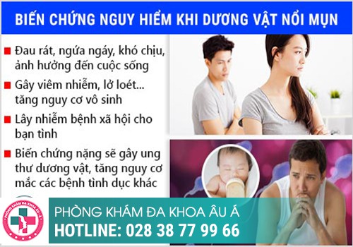 
						Nổi Mụn Dương Vật Chớ Nên Xem Thường!