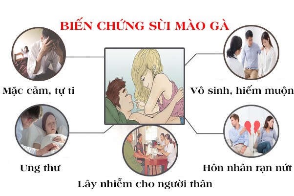 
						Phương Pháp Chữa Sùi Mào Gà Tốt Nhất