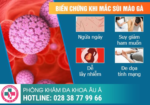 Các giai đoạn sùi mào gà và biểu hiện cụ thể