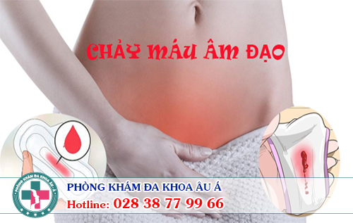 
						Chảy Máu Âm Đạo – Cẩn Thận Mắc bệnh xã hội Nguy Hiểm
