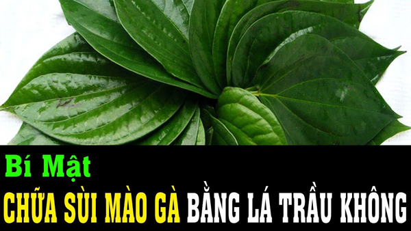 
						Chữa Sùi Mào Gà Bằng Lá Trầu Không