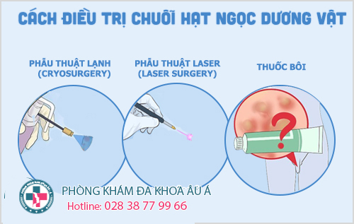 
						Chuỗi hạt ngọc dương vật và cách trị