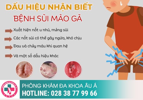 
						Dấu Hiệu Nhận Biết Ban Đầu Của Bệnh Sùi Mào Gà
