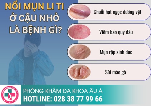 
						Nổi Mụn Li Ti Ở Cậu Nhỏ Là Dấu Hiệu Của Bệnh Gì?