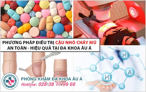 4 nguyên nhân khiến cậu nhỏ chảy mủ bạn cần biết 4 nguyên nhân khiến cậu nhỏ chảy mủ bạn cần biết