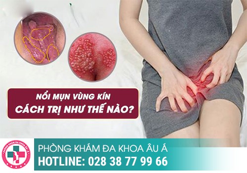 
						Mụn Nhọt Sưng To Ở Vùng Kín Và Cách Chữa Trị Hiệu Quả