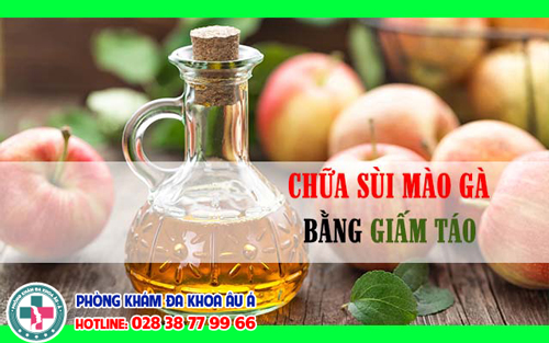 
						Giấm Táo Trị Sùi Mào Gà