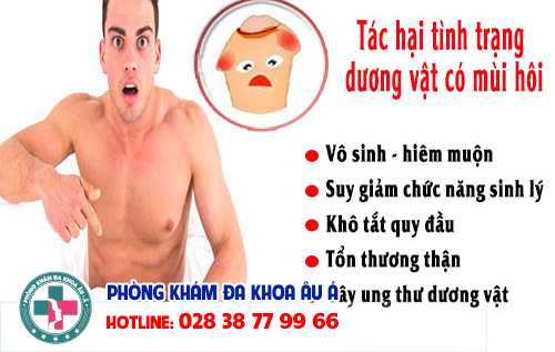 
						Dương Vật Có Mùi Hôi – Cẩn Thận Mắc Trọng Bệnh