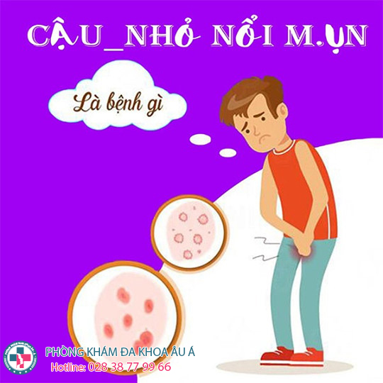 
						Dương Vật Nổi Mụn Nước – Cảnh Báo bệnh xã hội