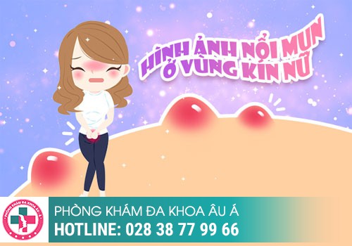 
						Mụn Thịt Ở Vùng Kín Là Dấu Hiệu Của Bệnh Lý Gì?
