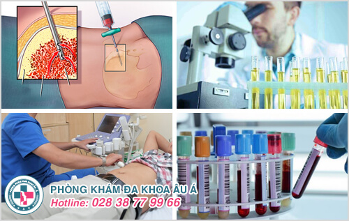 bệnh stds bệnh stds