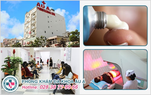 Thuốc trị rận mu loại nào tốt và hiệu quả nhất? Thuốc trị rận mu loại nào tốt và hiệu quả nhất?