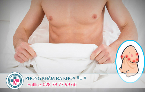 
						Tôi Đã Chữa Khỏi Tình Trạng Dương Vật Nổi Mụn Bằng Cách Sau