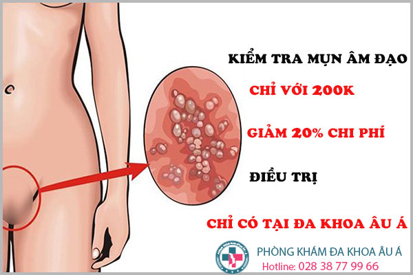
						Kiểm Tra Và Điều Trị Sớm Mụn Ở Âm Đạo Với Gói Combo Chỉ 200k