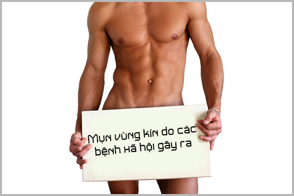 
						Mụn Nhọt Vùng Kín - Dấu Hiệu Bệnh Lý Nguy Hiểm Đừng Vội Chủ Quan