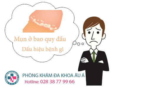 
						Bao Quy Đầu Nổi Mụn Trắng Là Bệnh Gì?