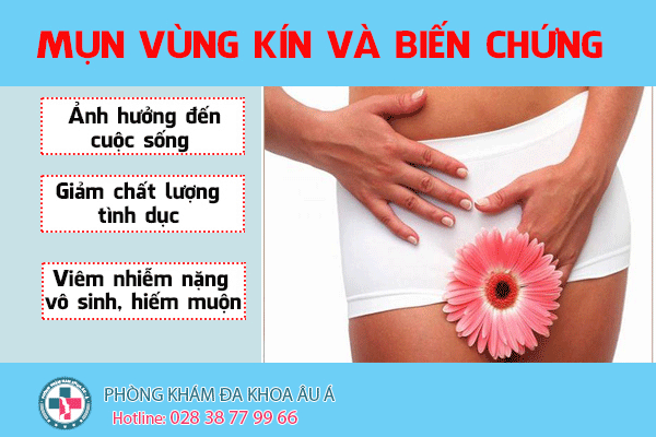 
						Nổi Mụn Vùng Kín Nữ Nguy Cơ Mắc Bệnh Lý Nguy Hiểm Dể Nhầm Lẫn
