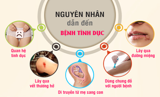 
						Các bệnh lây nhiễm qua đường tình dục