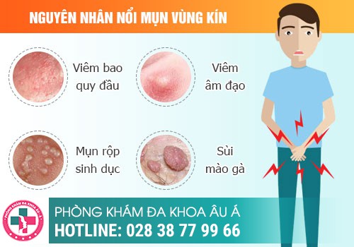 
						Nổi Mụn Li Ti Ở Bao Quy Đầu - Nguyên Nhân Và Cách Điều Trị Hiệu Quả