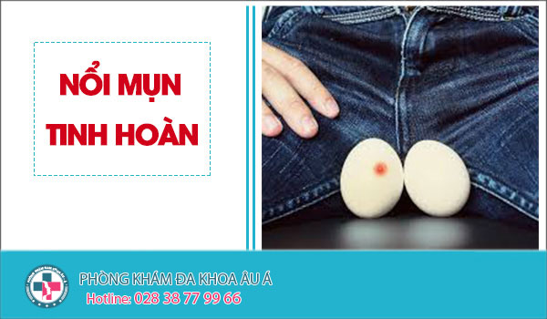 
						Khám Và Điều Trị Sớm Tình Trạng Mụn Ở Bìu