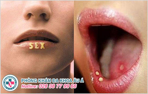 
						Quan Hệ Tình Dục Bằng Miệng Không Thực Sự An Toàn Như Bạn Nghĩ