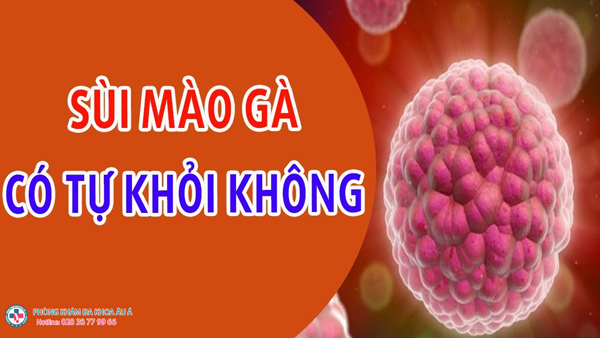 
						Sùi Mào Gà Có Tự Khỏi Không?