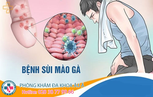 
						Sùi Mào Gà Dương Vật – Nhận Biết Để Chữa Trị Sớm Khi Còn Có Thể