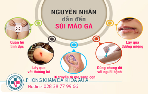 
						SÙI MÀO GÀ NGUY HIỂM ĐẾN MỨC ĐỘ NÀO?