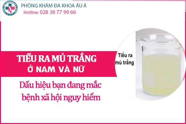
						Tiểu Ra Mủ Trắng Có Phải Bệnh Lậu?
