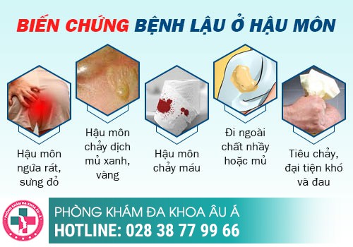 
						Dấu Hiệu Bệnh Lậu Ở Hậu Môn - Nguyên Nhân Và Cách Điều Trị Hiệu Quả