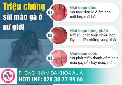 Các giai đoạn sùi mào gà và biểu hiện cụ thể