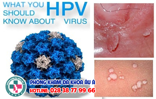 
						Virus HPV Sùi Mào Gà - Các Vấn Đề Bạn Cần Phải Biết